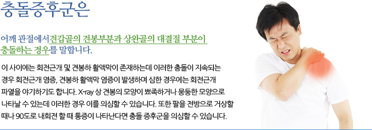 
	이 사이에는 회전근개 및 견봉하 활액막이 존재하는데 이러한 충돌이 지속되는 경우 회전근개 염증, 견봉하 활액막 염증이 발생하며 심한 경우에는 회전근개 파열을 야기하기도 합니다.
	X-ray 상 견봉의 모양이 뾰족하거나 뭉둥한 모양으로 나타날 수 있는데 
	이러한 경우 이를 의심할 수 있습니다. 또한 팔을 전방으로 거상할 때나 90도로 내회전 할 때 통증이 나타난다면 충돌 증후군을 의심할 수 있습니다.
	