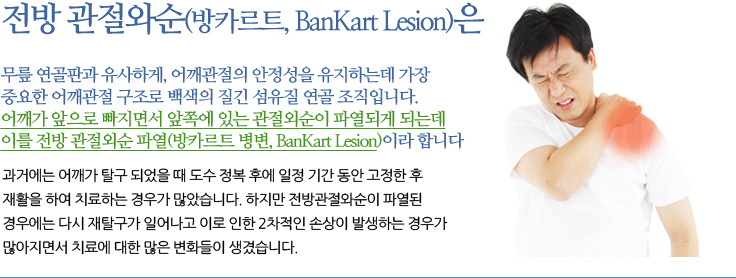 전방 관절와순 파열 (Bankart lesion) 관절와순은 무릎 연골판과 유사한 기능을 하는 어깨 관절내의 연골판을 의미합니다. 어깨가 앞으로 빠지면서 앞쪽에 있는 관절와순이 파열되게 되는데 이를 전방 관절와순 파열이라 합니다.
	과거에는 어깨가 탈구 되었을 때 도수 정복 후에 일정 기간 동안 고정한 후 재활을 하여 치료하는 경우가 많았습니다. 하지만 전방
	관절와순이 파열된 경우에는 다시 재탈구가 일어나고 이로 인한 2차적인 손상이 발생하는 경우가 많아지면서 치료에 대한 많은 
	변화들이 생겼습니다. 
	