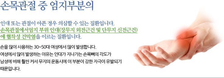 드꾀르벵 병(DeQuervain Disease) 손목관절 중 엄지부분의 인대 또는 관절이 아픈 경우 의심할 수 있는 질환입니다. 손목관절에서엄지 부위 인대(장무지 외전근건 및 단무지 신전근건)에 협착성 건막염을 이르는 질환입니다
	손을 많이 사용하는 30~50대 여성에서 많이 발생합니다. 여성에서 많이 발생하는 이유는 인대가 지나가는 손목뼈의 각도가 남성에 비해 훨씬 커서 무지의 운동시에 이 부분이 강한 자극이 유발되기 때문입니다.
	