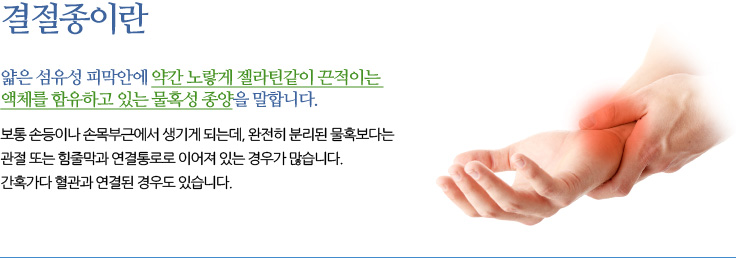 결절종(Ganglion) 결절종이란 얇은 섬유성 피막안에 약간 노랗게 젤라틴같이 끈적이는 액체를 함유하고 있는 물혹성 종양을 말합니다. 보통 손등이나 손목부근에서 생기게 되는데, 완전히 분리된 물혹보다는 관절 또는 힘줄막과 연결통로로 이어져 있는 경우가 많습니다. 