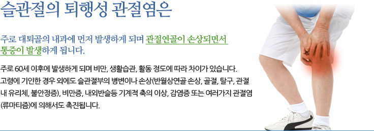 퇴행성 관절염 슬관절의 퇴행성 관절염은 주로 대퇴골의 내과에 먼저 발생하게 되며 관절연골이 손상되면서 통증이 발생하게 됩니다.주로 60세 이후에 발생하게 되며 비만, 생활습관, 활동 정도에 따라 차이가 있습니다 