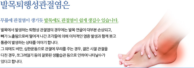 발목퇴행성관절염 무릎에 관절염이 생기듯 발목에도 관절염이 쉽게 생길수 있습니다. 발목에서 발생하는 퇴행성 관절염의 경우에는 발목 연골이 대부분 손상되고, 뼈가 노출됨으로써떨어져 나간 조각들에 의해 이차적인 염증 발생과 함께 붓고 통증이 발생하는 상태를 이야기 합니다.
	무릎에 관절염이 생기듯 발목에도 관절염이 쉽게 생길수 있습니다. 발목에서 발생하는 퇴행성 관절염의 경우에는 발목 연골이 대
	부분 손상되고, 뼈가 노출됨으로써 떨어져 나간 조각들에 의해 이차적인 염증 발생과 함께 붓고 통증이 발생하는 상태를 이야기 
	합니다.
	