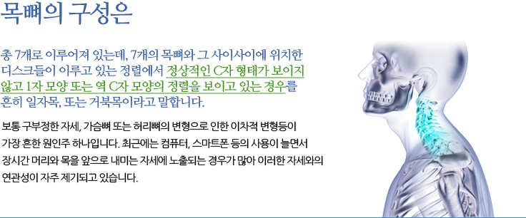 일자목 / 거북목
	목뼈는 총 7개로 이루어져 있는데, 7개의 목뼈와 그 사이사이에 위치한 디스크들이 이루고 있는 정렬에서 
	정상적인 C자 형태가 보이지 않고 1자 모양 또는 역 C자 모양의 정렬을 보이고 있는 경우를 흔히 일자목, 
	또는 거북목이라고 말합니다. 
	보통 구부정한 자세, 가슴뼈 또는 허리뼈의 변형으로 인한 이차적 변형등이 가장 흔한 원인주 하나입니다. 최근에는 컴퓨터, 
	스마트폰 등의 사용이 늘면서 장시간 머리와 목을 앞으로 내미는 자세에 노출되는 경우가 많아 이러한 자세와의 연관성이 자주 
	제기되고 있습니다.
	